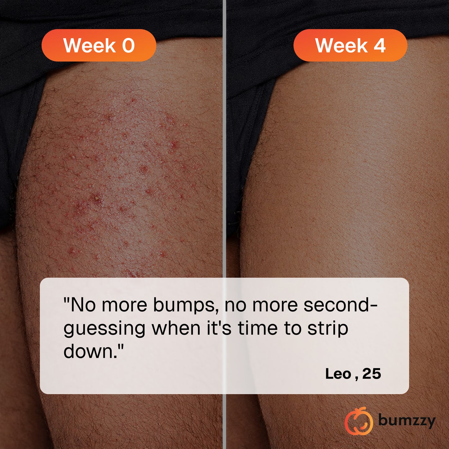 Bumzzy Zapper
